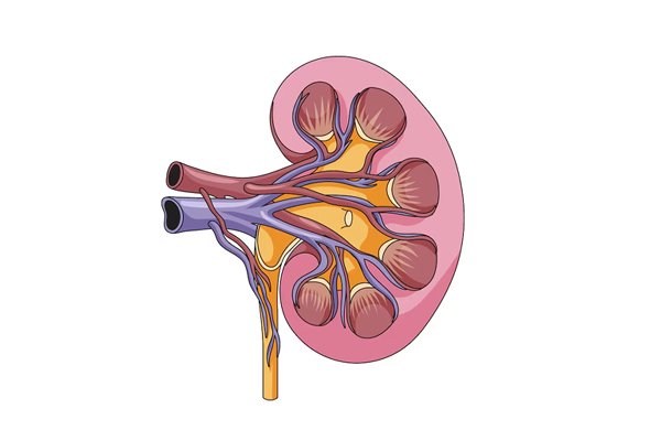 Kidney Failure